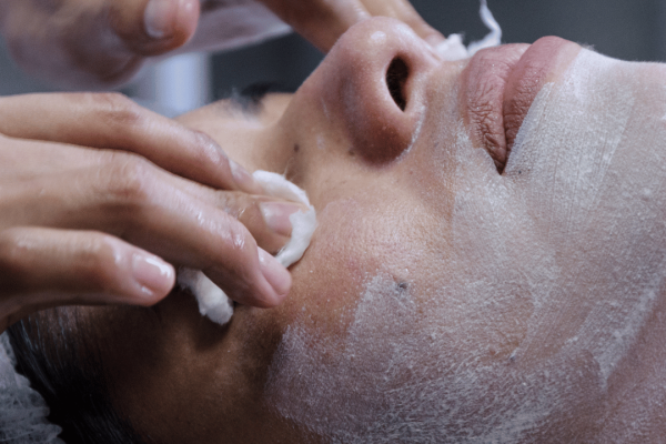 tratamientos faciales